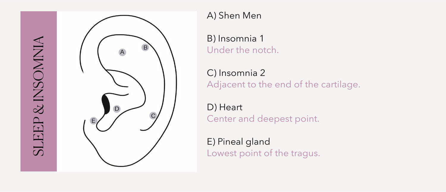 A diagram of an ear with five labeled points: Shen Men, Insomnia 1, Insomnia 2, Heart, and Pineal Gland. Each point is labeled with a letter and a brief description of its location.